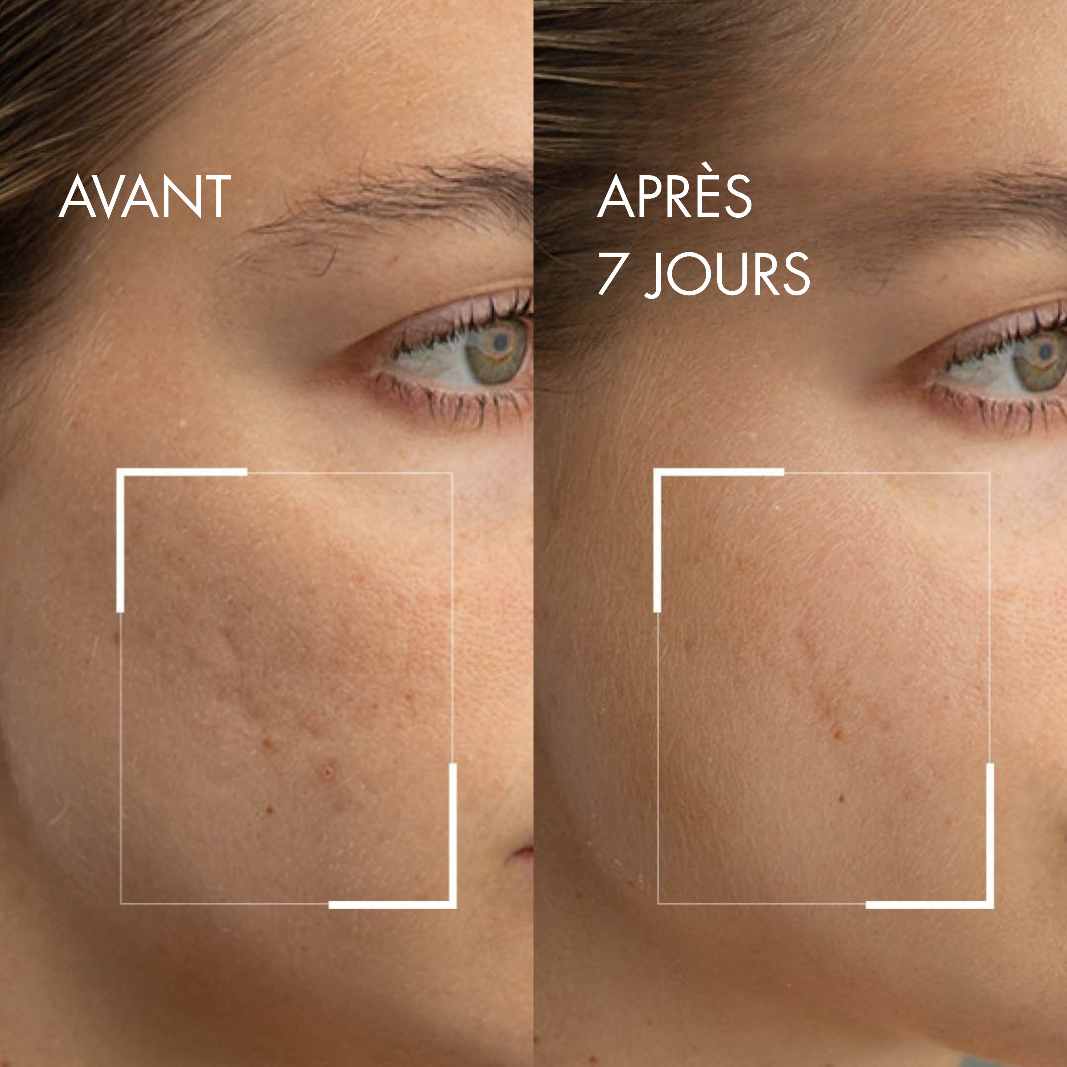 Soin Exfoliant au Riz